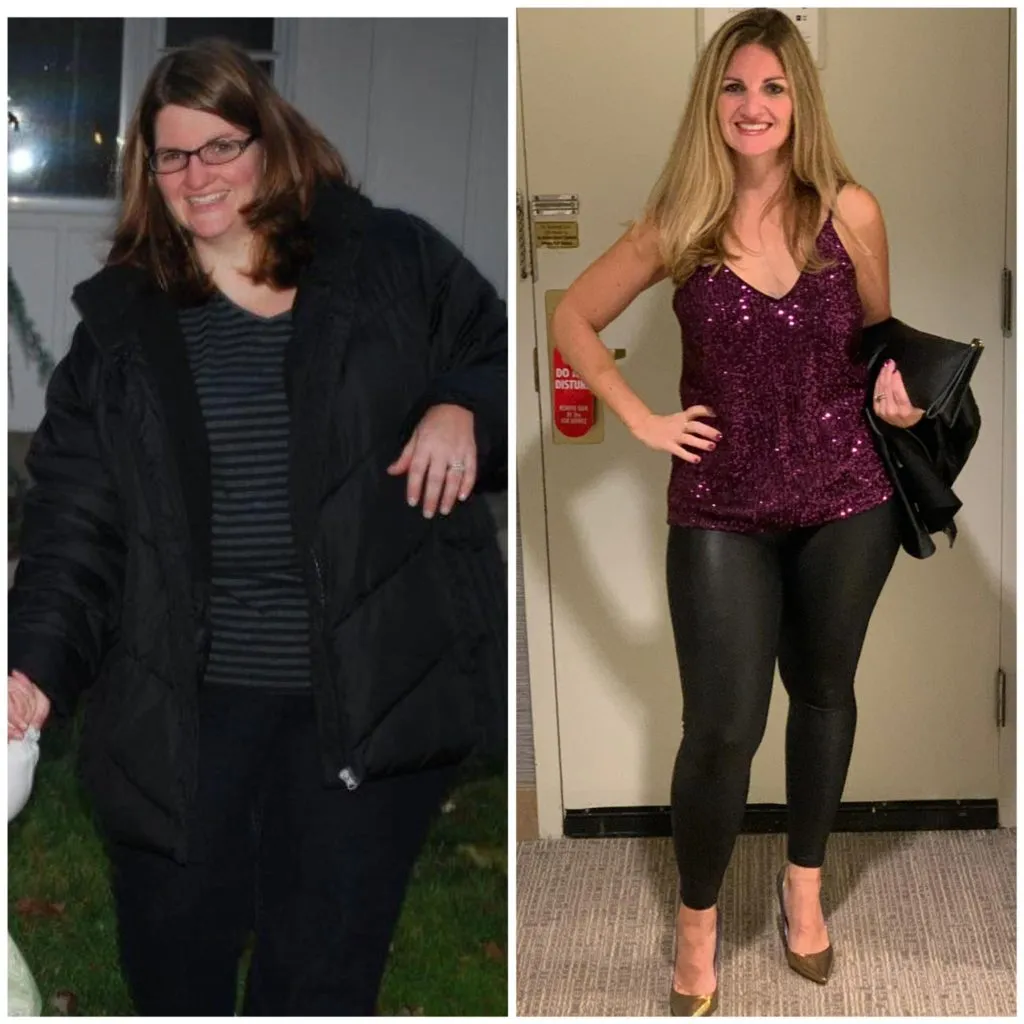 Gastric Sleeve Result