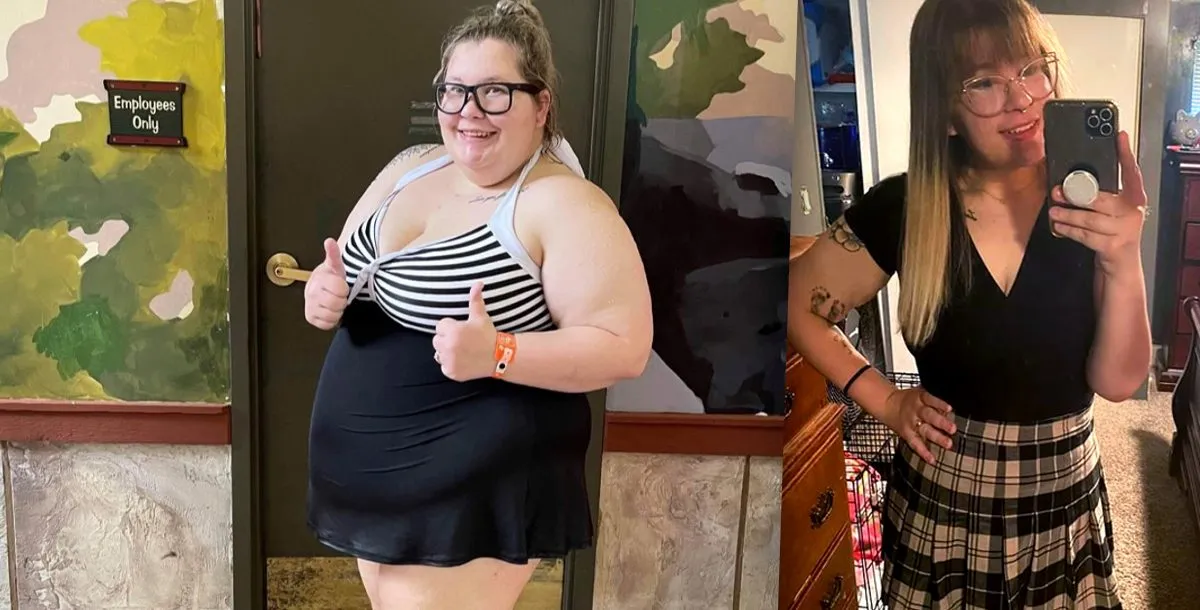 Gastric Sleeve Result